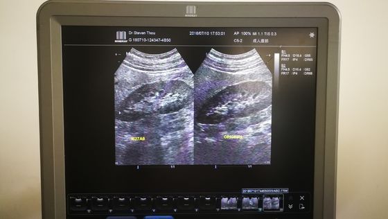 Ultrasonic Convex Probe Compatible with Mindray C5-2 DC-7/N6/T6 Ultrasound Scanner
